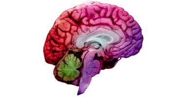 مخ بشرى - صورة أرشيفية